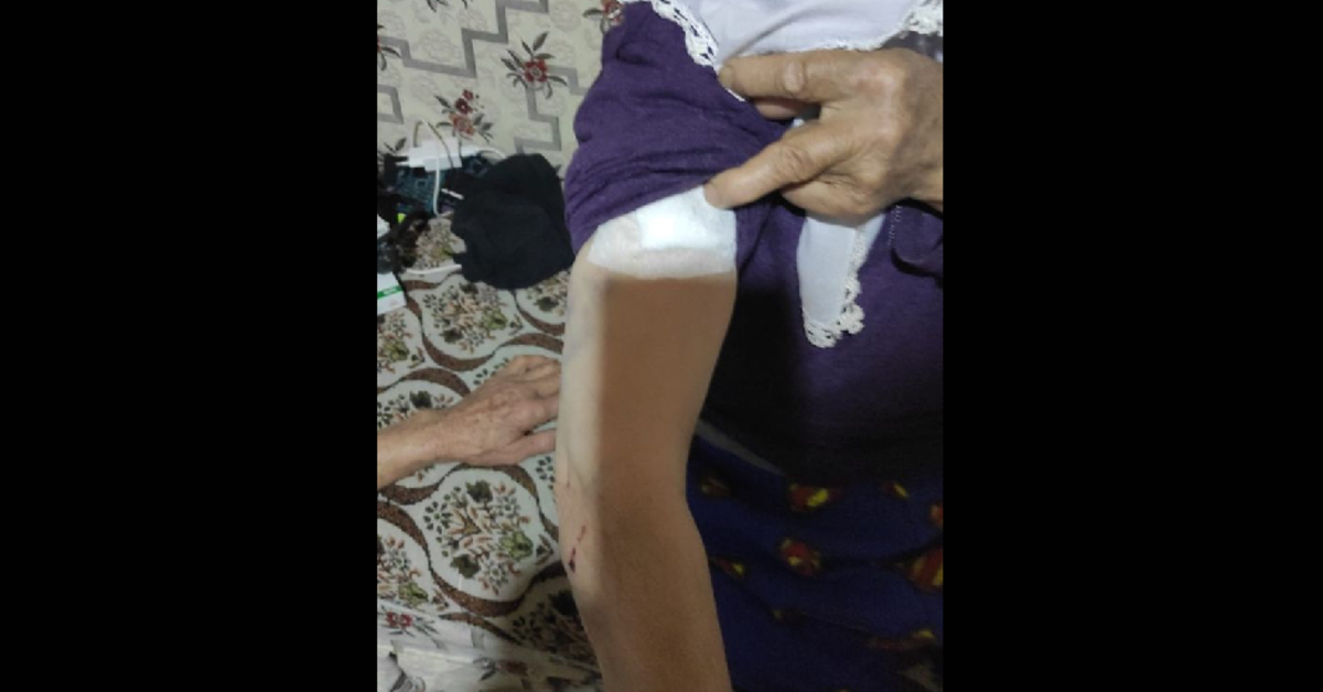 Burdur’da sahipsiz köpeklerin saldırdığı kadın yaralandı